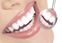 Trucuri pentru albirea dintilor