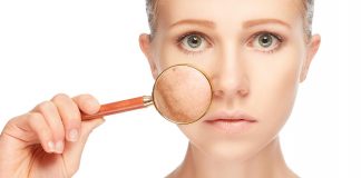 Remedii pentru reducerea petelor: 5 alternative